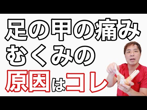 【足の甲がむくむ 】足のむくみを解消する方法