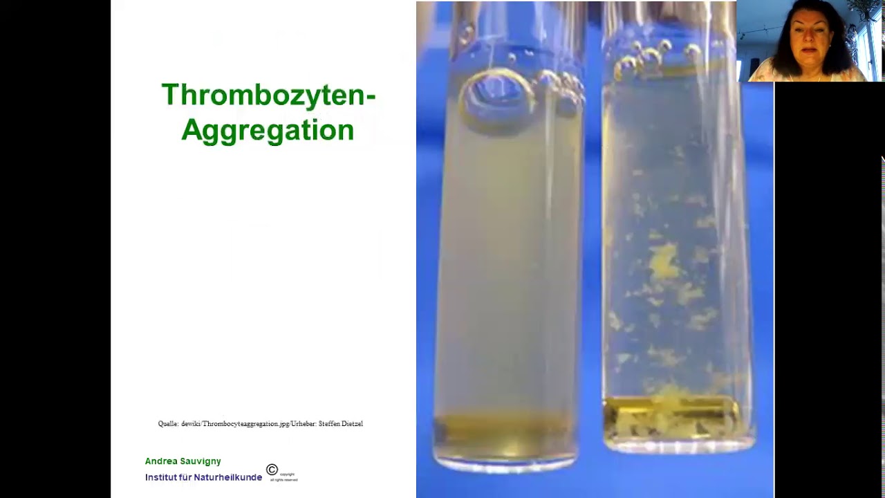 Blutverdünner Teil 1 Grundlagen 2018 03 02 YouTube