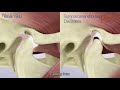 The temporomandibular joint (TMJ) and temporomandibular disorder (TMD) symptoms and causes