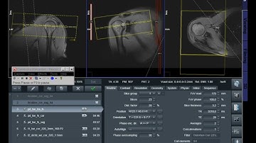 MRI Shoulder Joint Planning and Protocol Siemens 1.5 Tesla