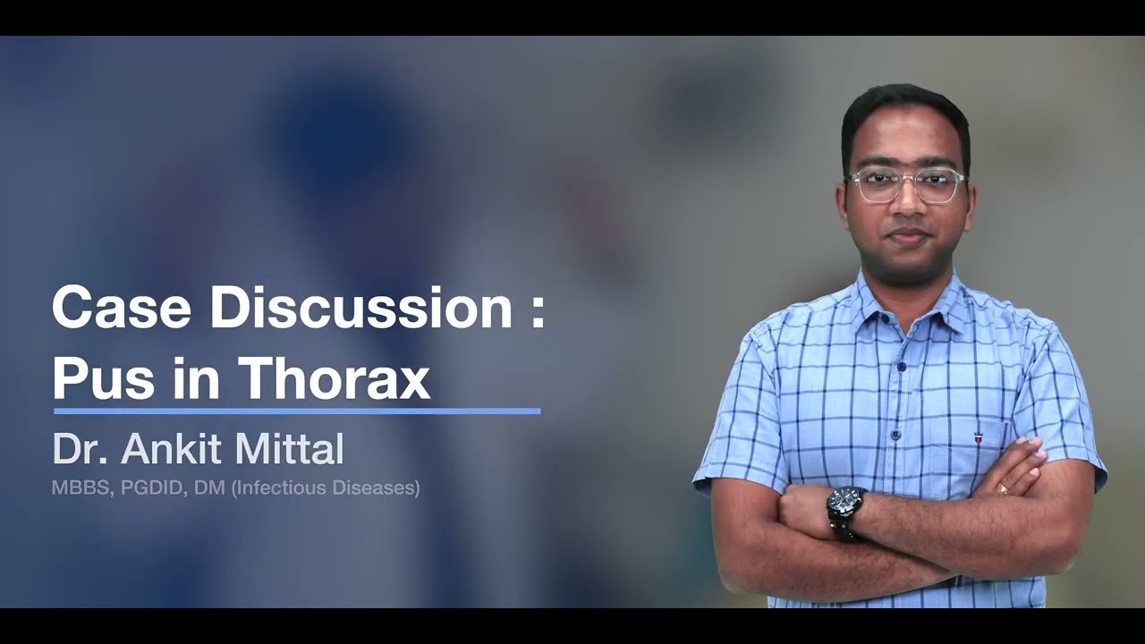 Обсуждение случая: Гной в грудной клетке — д-р Анкит Миттал | Фонд медицины | SS Medicine