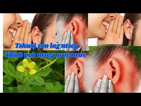 Video: Capsule Earpiece: Cov Yam Ntxwv Ntawm Lub Mloog Pob Ntseg Tsiav Tshuaj. Yuav Ua Li Cas Muab Nws Tso Rau Hauv Koj Pob Ntseg?