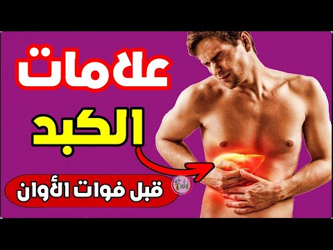 علامات مهمة تدل على أن الكبد لديك في ورطة فإذا ظهرت عليك فهي إشارة واضحة بأن الكبد مليء بالسموم