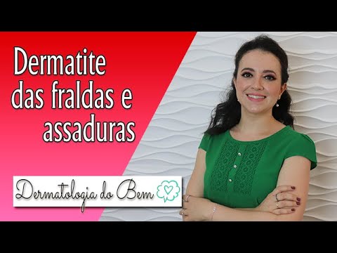 ASSADURAS e Dermatite  das Fraldas - Saiba como evitar! I Dermatologia do Bem