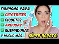 CREMA PARA ROZADURAS HACE MARAVILLAS PARA TU PIEL!! Y ES SÚPER BARATA!! | MARIEBELLE COSMETICS