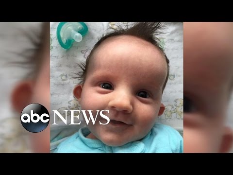 Basset Hounds Wouldn't Leave Dying Infant's Side, Mom Says