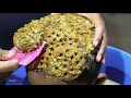 OMG! Removal Worm Flakes On Scalp!! Satisfying Psoriasis Dandruff #395