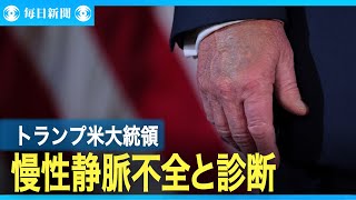 トランプ氏の写真に異変　ホワイトハウス、「慢性静脈不全」と明かす
