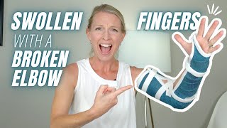 5 Treatment Tips for Swollen Fingers After Broken Elbow: Why Fingers Swell and How to Help