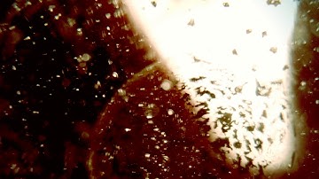 SPLEEN CHANNEL/MERIDIAN SYSTEM RESONANCE | MAGNETO - DIELECTRIC ( SCALAR ) FIELDS