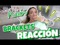 REACCIÓN!!😱ME QUITAN LOS BRACKETS⎮Vlogs diarios