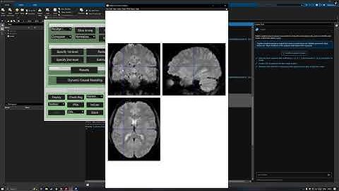 check reg for normalization of the anatomical image SPM12 Matlab