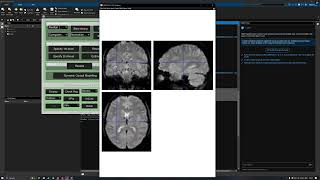 check reg for normalization of the anatomical image SPM12 Matlab