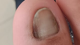 Pedicure April 17 #satisfying Neldz SOLO Parent  is live!