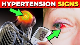 6 Warning Signs of High Blood Pressure (Hypertension) by Incredibly Healthy 3,782 views 1 month ago 10 minutes, 1 second