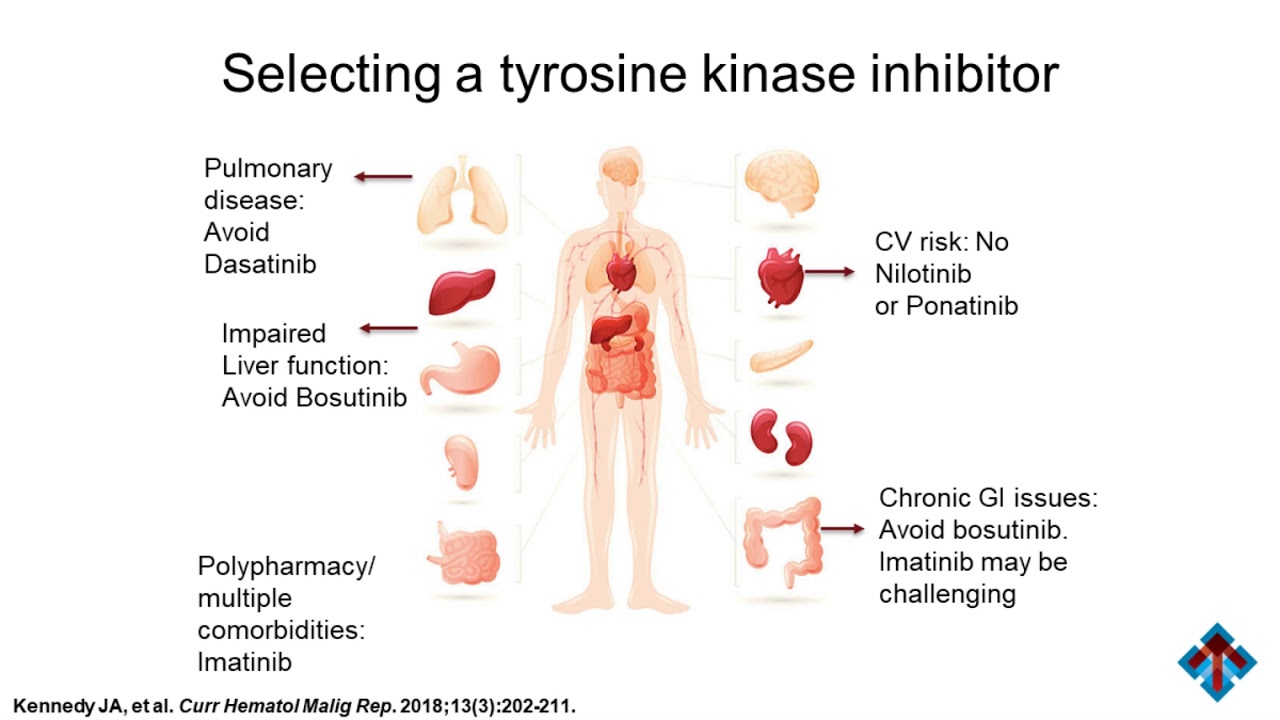 Chronic Myeloid Leukaemi Symptoms And Treatment