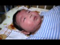 顔の乳児湿疹とアトピー 生後3ヵ月