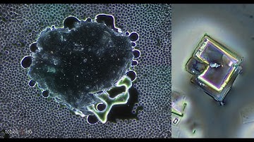 Anomalies In Blood: Are You Curious?