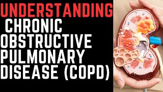 COPD Explained: Lung Cough, Chronic Symptoms, Causes Fatigue