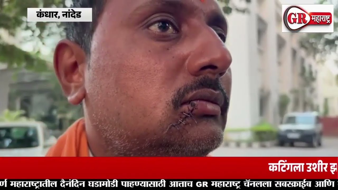 सलून चालकावर ब्लेडने गंभीर हल्ला,कटिंगला उशीर झाल्याने घडला प्रकार 