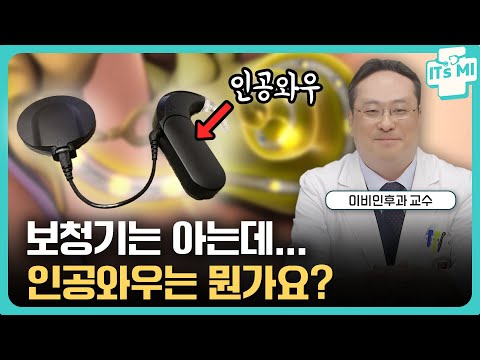 보청기는 아는데... 인공와우는 뭔가요? | 이비인후과 임기정 교수 EP.29