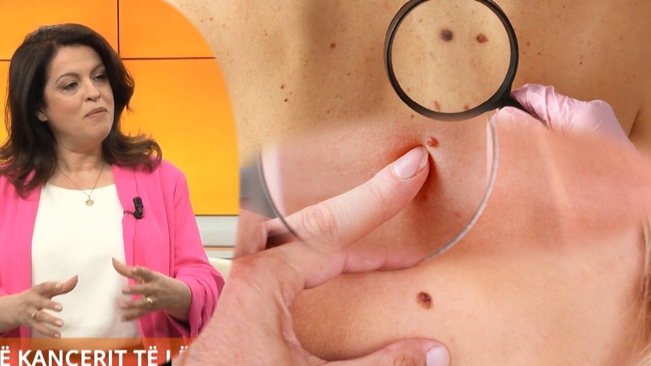 Kujdes nga këto forma nishanesh… Ja kur duhet të shqetësoheni