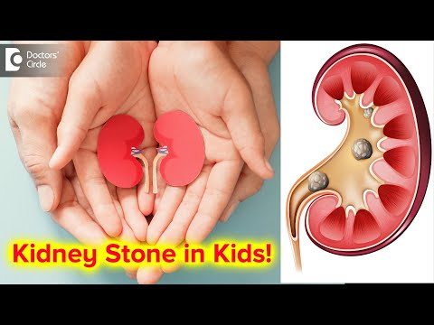 Kidney stones in Newborn, Toddlers & Children | Causes & Genes-Dr. Girish Nelivigi | Doctors&rsquo; Circle