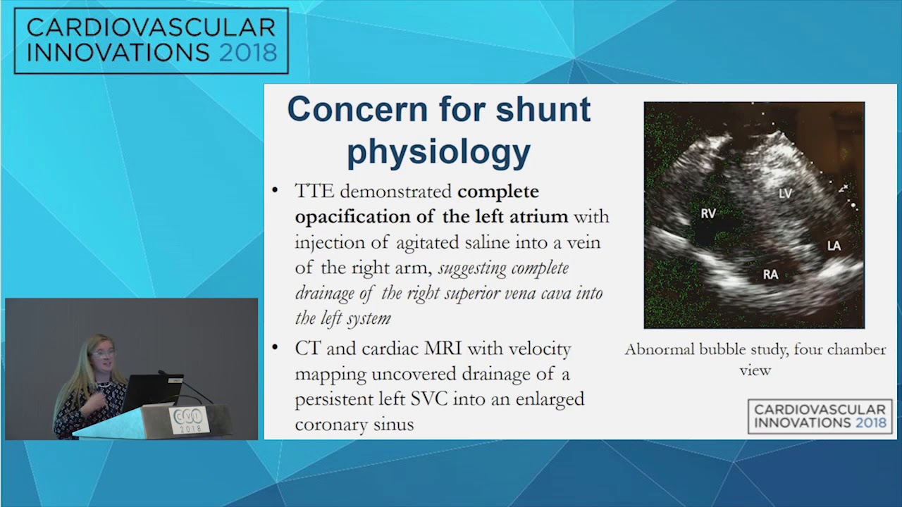 CVI2018 Session: First Reported Case of Duplicate SVC with Cross Drainage - Kiersten Frenchu interventional cardiology jobs