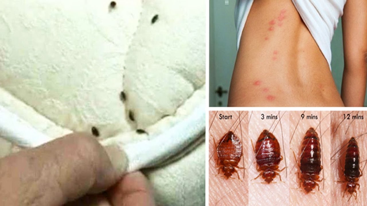 How to Get Rid of Bed Bugs Naturally From Your Entire Home ...