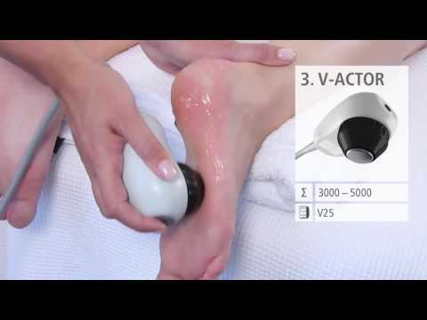 დარტყმით-ტალღური თერაპია: ქუსლის დეზის მკურნალობა : caucas-medical.com