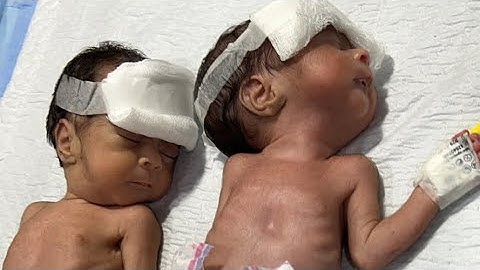 NICU newborn sleeping 🛌 |  Specific topics |  Premature baby support |