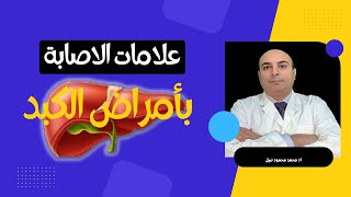 علامات الاصابه بأمراض الكبد