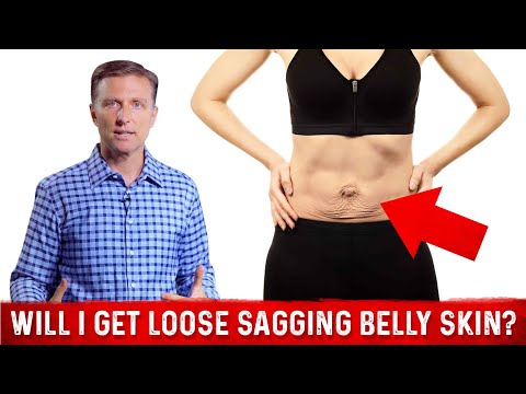 If I Lose Too Much Weight on the Ketogenic diet - Will I Get Loose Sagging Belly Skin?