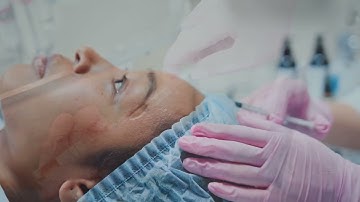 Animal testing and botox