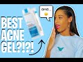 LA ROCHE POSAY Effaclar Adapalene 0.1 Gel Skincare Review: 2020 | This Gel is...😮  | Lizette Baldeo