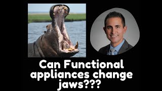 #3 Can Functional Appliances Change Jaws? Herbst, Mara, Activator, Twin Block, Forsus