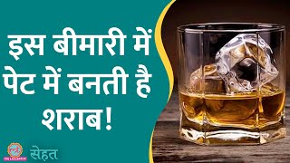 क्या है Auto Brewery Syndrome जिसमें बिन पिए इंसान नशे में रहता है? | Sehat ep 580