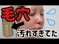 【閲覧注意】毛穴汚れヤバい。ハイドラフェイシャル最高。