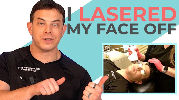 Der ultimative Hautpflege-Guide: Resurfacing-Laserbehandlung mit dem Halo-Laser