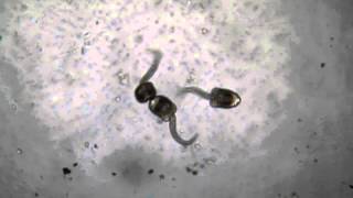 Cercariae From Physa, 40X