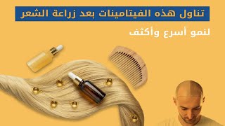 أفضل فيتامينات لتطويل الشعر بعد زراعة الشعر Vitamine D