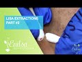 Lisa Extractions Part 2