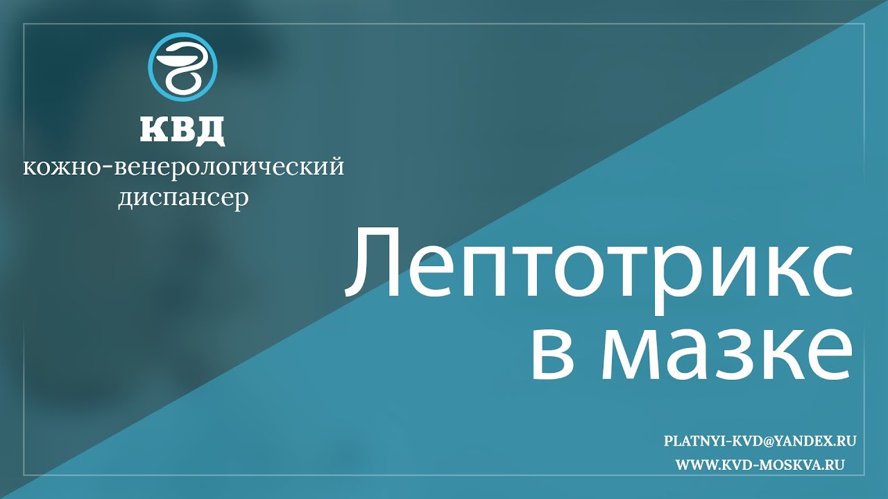 171 Лептотрикс в мазке