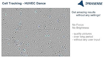 HUVEC Dance - Cell Tracking