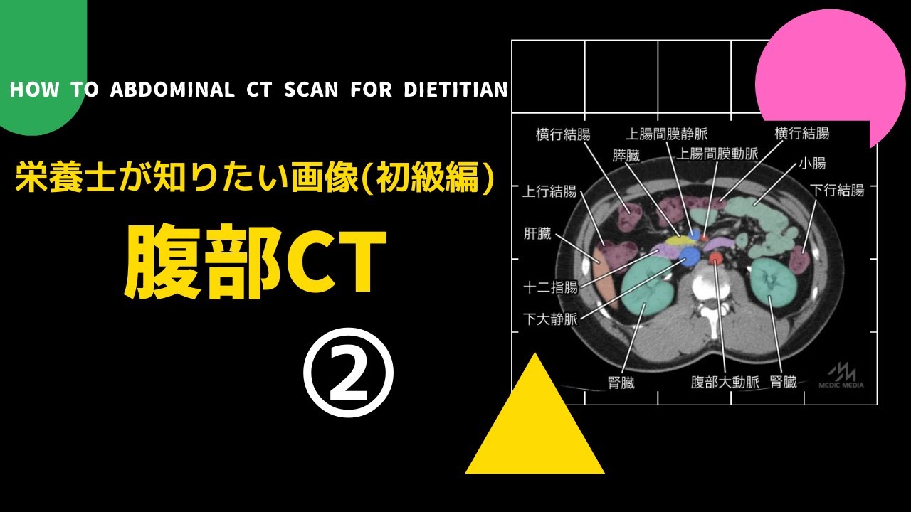 腹部 ct で わかる こと 胃