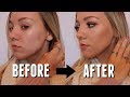 Acne Coverage Foundation Routine