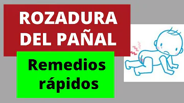 ¿Cómo se usa el talco de bebé para las rozaduras?