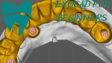 Fastest Exocad Video Tutorial - Full Anatomic Screw Retained Bridge