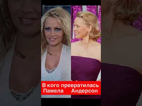 Секс-символ 90-х стала… тётей Пэм?! 😱 Что случилось с Памелой Андерсон?