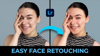 Complete Face Retouch & Pimple Removal in #lightroom #malayalam screenshot 4